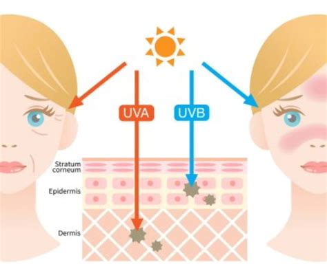 Infografika o rizikových faktoroch melanómu (UV žiarenie, typ kože, znamienka)