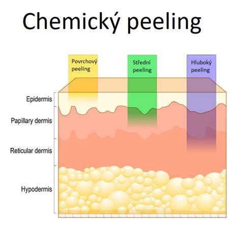 Schéma pôsobenia fyzikálnych a chemických UV filtrov na pokožku