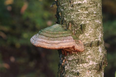 Grafika: Mikroflóra pošvy a huba Candida