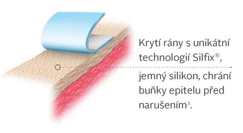 Ilustrácia rôznych typov moderných krytí na rany používaných pri liečbe dekubitov.