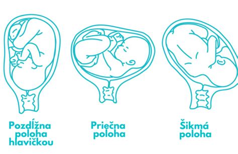 Ilustrácia plodu v maternici s možným rizikom infekcie