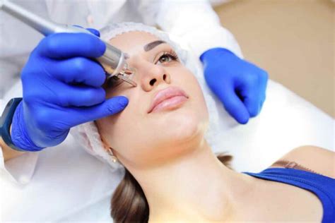 Tematické foto: Dermatologický zákrok s laserom na odstránenie pigmentových škvŕn