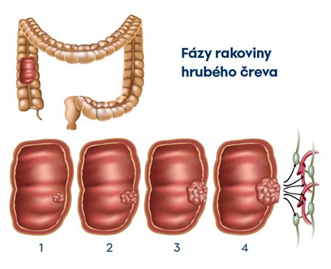 Anatomický nákres slepého čreva a jeho umiestnenia
