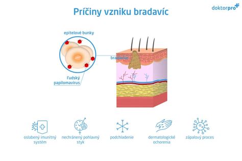 Schéma štruktúry a typov ľudského papilomavírusu (HPV)