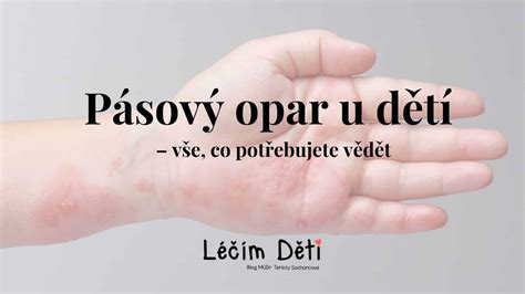 Tabuľka liekov a ich účinkov na pásový opar