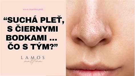 Tematické foto tváre s čiernymi bodkami a produktmi na starostlivosť o pleť