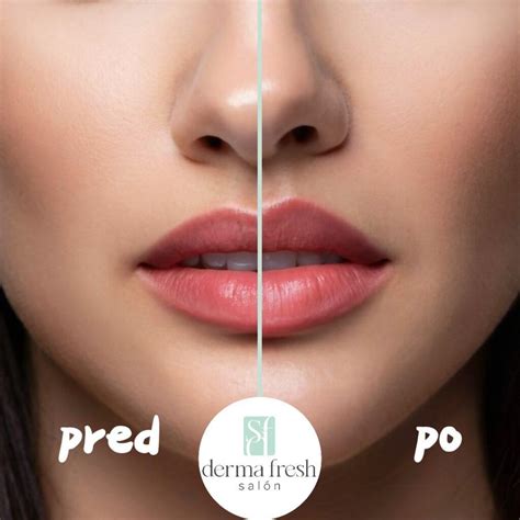 ilustrácia peel-off rúžu na pery pred a po stiahnutí