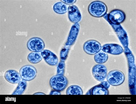 ilustračné foto: Candida albicans pod mikroskopom
