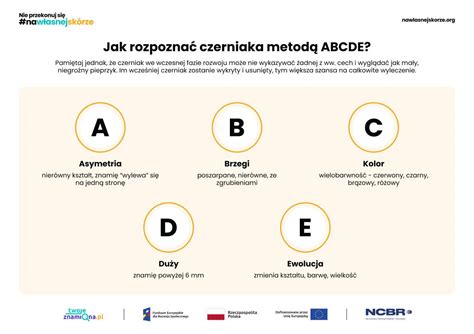 Infografika: ABCDE pravidlo pre rozpoznanie melanómu