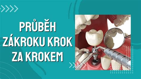 Ilustrácia procesu rekonvalescencie po gynekologickom zákroku