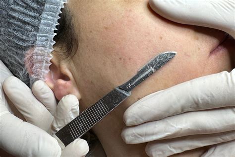 Schéma porovnávajúca dermaplaning, mikrodermabráziu a hydradermabráziu
