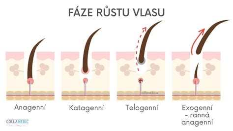 Infografika zobrazujúca cyklus rastu vlasu a porovnanie zdravej vlasovej folikuly s folikulou postihnutou alopéciou.
