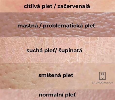 Infografika: rozdiely medzi typmi pleti (suchá, mastná, zmiešaná, citlivá)