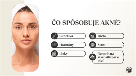 Schéma vzniku akné - nadprodukcia mazu, upchaté póry a zápal