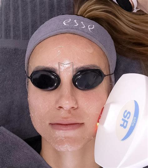 schéma princípu fototermolýzy IPL svetlom v pleti