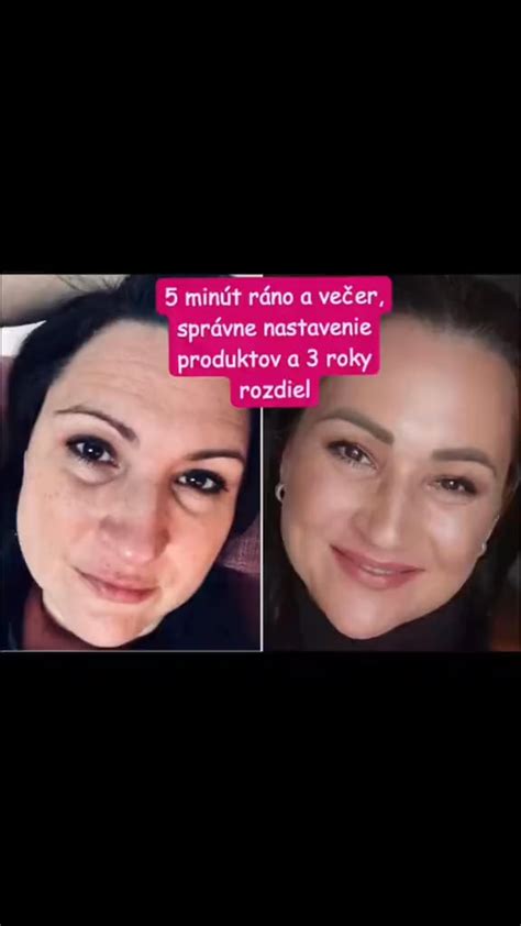 Infografika: Ako retinol pôsobí na pleť