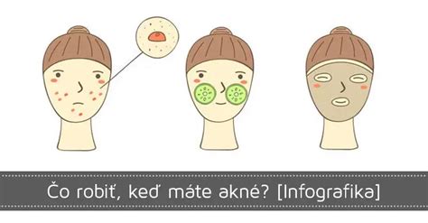 infografika s typmi akné a príčinami vzniku