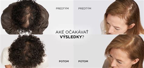 tematické foto zdravých vlasov
