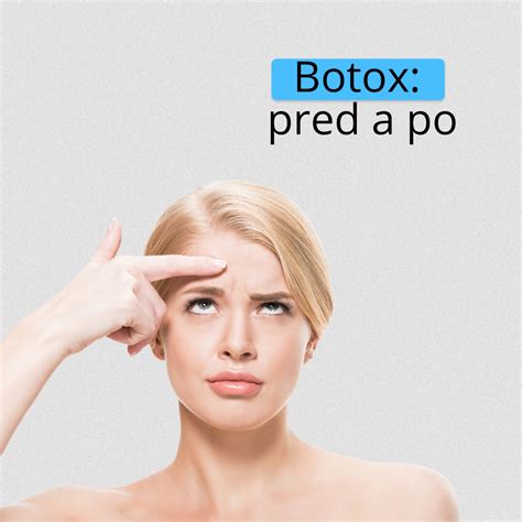 fotografia licencovaného lekára vykonávajúceho zákrok botoxu