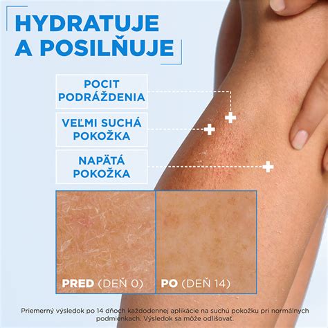 Tematická fotografia: Upokojená a hydratovaná pokožka po opaľovaní