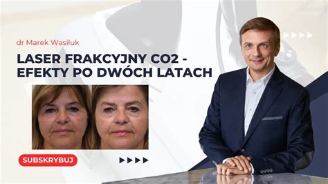 Schéma fungovania frakčného CO2 lasera s vyznačením mikrotermálnych zón v pokožke