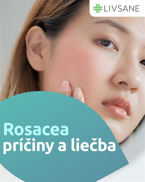 Laserová liečba rosacey: cievky a začervenanie pred a po zákroku