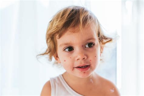 Ilustrácia rôznych typov kožných vyrážok a ich možných príčin