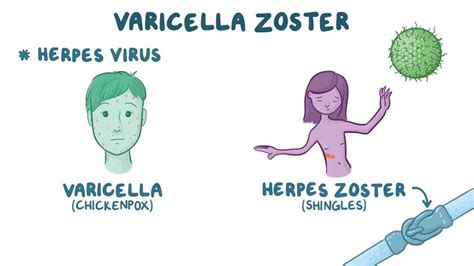 ilustrácia vírusu varicella zoster a jeho prejavov na koži