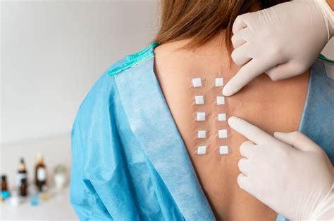 Ilustrácia: patch test na pokožke