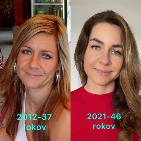 infografika: pred a po výsledky tvárovej gymnastiky
