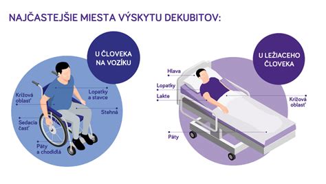 infografika o príčinách vzniku dekubitov (tlak, trenie, strižné sily) a rizikových faktoroch