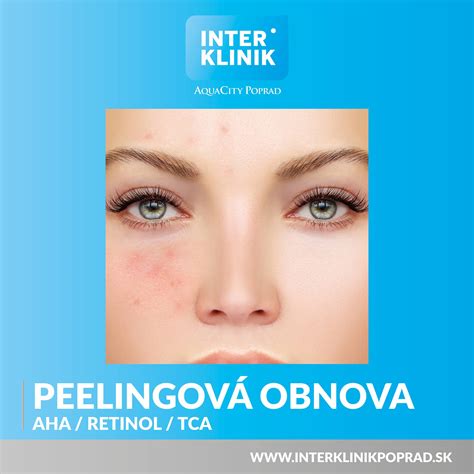 Fotografia: Detail jemnej a žiarivej pokožky po peelingu