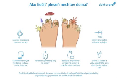 infografika o príčinách a rizikových faktoroch mykózy nechtov