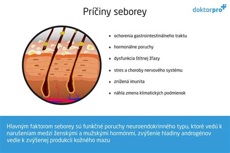 infografika: príčiny seboroickej dermatitídy