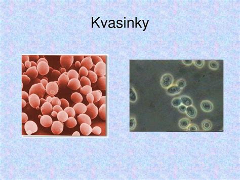 Ilustrácia znázorňujúca kvasinky rodu Candida