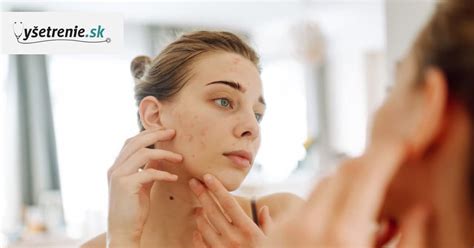 Zoznam aktívnych zložiek proti akné s krátkym popisom účinku