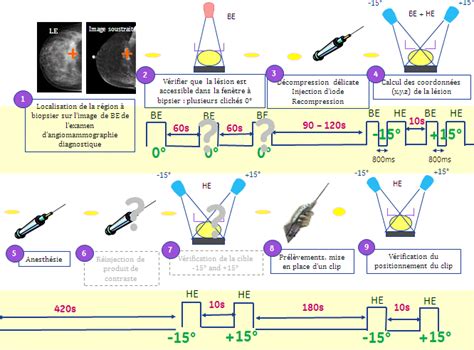 Schéma: Proces kožnej biopsie