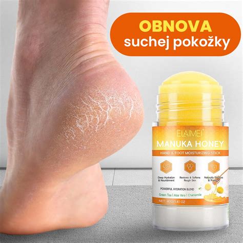 Detailná fotografia začervenanej, suchej a popraskanej pokožky postihnutej ekzémom