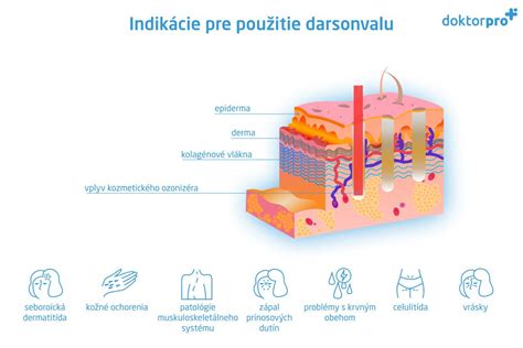 Infografika: Indikácie pre IPL fotorejuvenizáciu