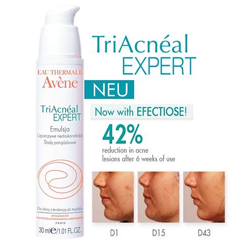 Infografika: Kľúčové zložky Avene Triacneal Expert a ich účinky