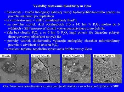 Štruktúra tváre s vyznačenými typickými oblasťami postihnutými rosaceou