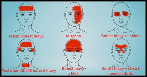 Ilustrácia znázorňujúca zmiešaný typ pokožky hlavy s rôznymi oblasťami