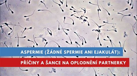 Zblízka: Štruktúra mužského ejakulátu