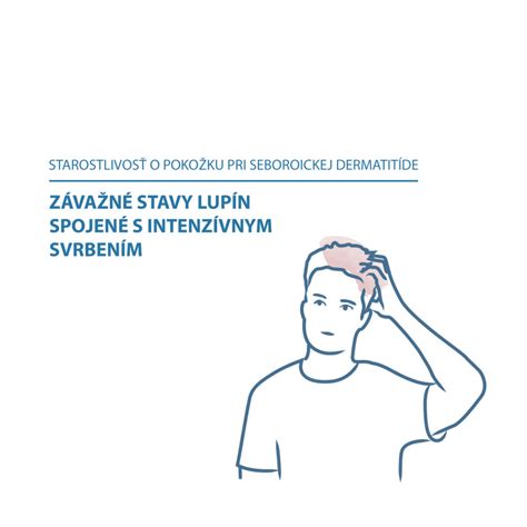ilustrácia kožných zápalov pri seboroickej dermatitíde