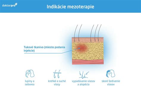 Schéma vrstiev kože a mazových žliaz