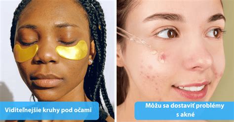 Tematické foto tváre s problematickou pleťou