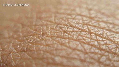 Schéma štruktúry ľudskej kože s vyznačením vlasových folikulov a potných žliaz pre lepšie pochopenie dermatologickej praxe