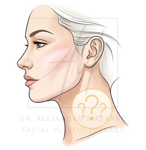 ilustrácia ženy podstupujúcej bezskalpelový facelifting