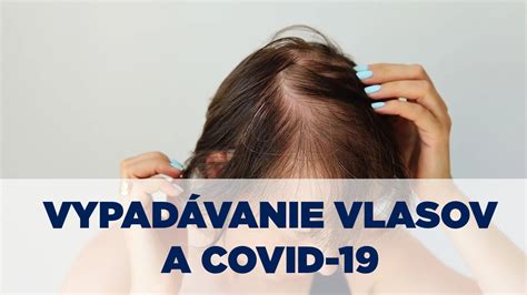 Ilustrácia znázorňujúca rôzne problémy s vlasovou pokožkou: lupiny, vypadávanie vlasov, začervenanie
