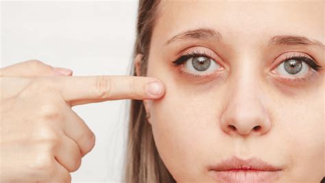 Ilustrácia znázorňujúca príznaky hypotermie, ako je tras, bledá pokožka a zmätenosť.